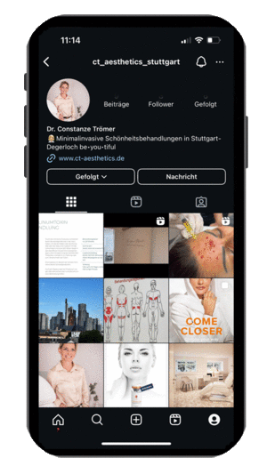 ct-aesthetics auf Instagram ct-aesthetics auf Instagram
